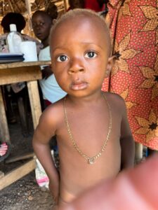 2-year-old, Sma, doing well in the malnutrition program
