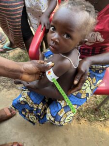 Child being evaluated for malnutrition with the MUAC (Mid upper arm circumference). Results are "in red" meaning they are malnourished. 
